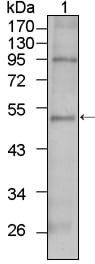 Mouse Monoclonal Antibody to TBX5