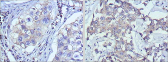 Mouse Monoclonal Antibody to RTN3