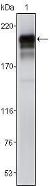 Mouse Monoclonal Antibody to PDGFR