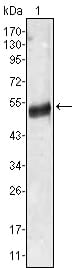 Mouse Monoclonal Antibody to AGT