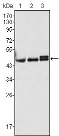 Mouse Monoclonal Antibody to CK17