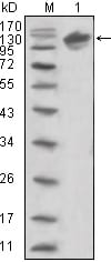 Mouse Monoclonal Antibody to ERBB3
