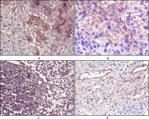 Mouse Monoclonal Antibody to NT5E