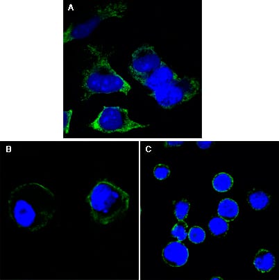 Mouse Monoclonal Antibody to RTN3