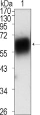 Mouse Monoclonal Antibody to ROR1
