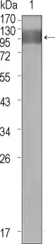 Mouse Monoclonal Antibody to FLT1