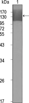 Mouse Monoclonal Antibody to KDR