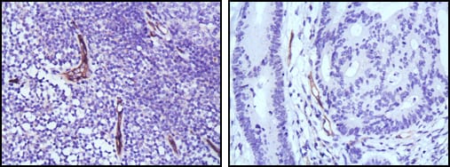 Mouse Monoclonal Antibody to eNOS