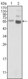 Mouse Monoclonal Antibody to PTEN