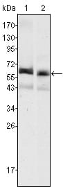 Mouse Monoclonal Antibody to AFP