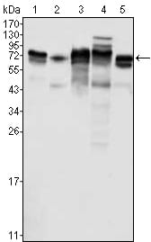 Mouse Monoclonal Antibody to Metadherin