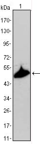 Mouse Monoclonal Antibody to KRT15