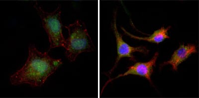 Mouse Monoclonal Antibody to CTNNB1