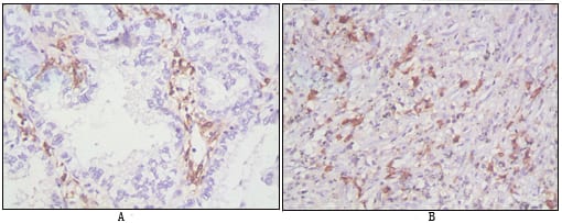 Mouse Monoclonal Antibody to CD38