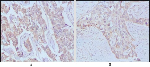 Mouse Monoclonal Antibody to EGF