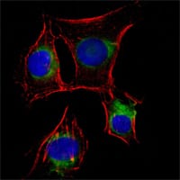 Mouse Monoclonal Antibody to NGFR