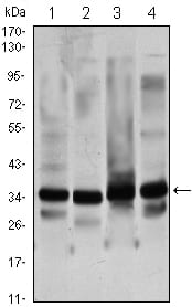 Mouse Monoclonal Antibody to GTF2B