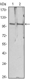 Mouse Monoclonal Antibody to HDAC4