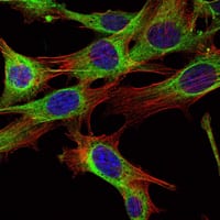 Mouse Monoclonal Antibody to ABL2