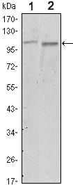 Mouse Monoclonal Antibody to FAK