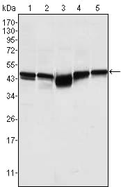 Mouse Monoclonal Antibody to GSK3B