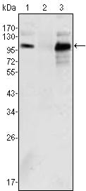 Mouse Monoclonal Antibody to Androgen receptor
