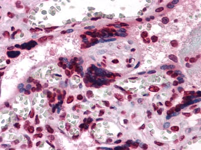 Mouse Monoclonal Antibody to CSF1