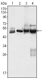 Mouse Monoclonal Antibody to CK7