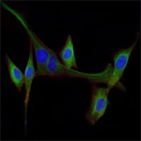 Mouse Monoclonal Antibody to EGF