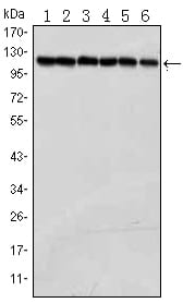 Mouse Monoclonal Antibody to PARP