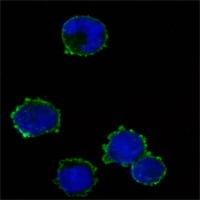 Mouse Monoclonal Antibody to CD247