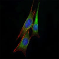Mouse Monoclonal Antibody to ETS1