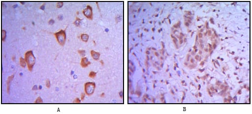 Mouse Monoclonal Antibody to ETS1
