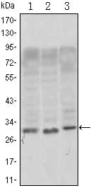 Mouse Monoclonal Antibody to CD69