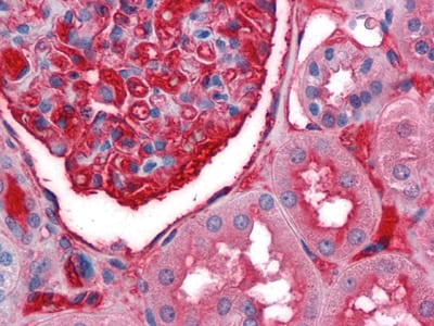 Mouse Monoclonal Antibody to A1BG