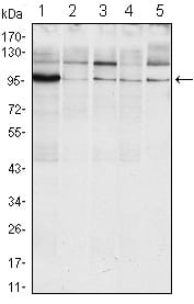 Mouse Monoclonal Antibody to ERN1