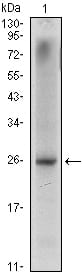Mouse Monoclonal Antibody to NKX3A