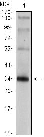 Mouse Monoclonal Antibody to SYP