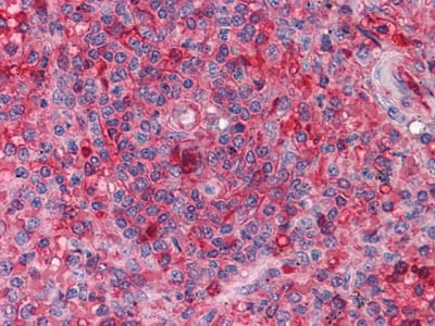 Mouse Monoclonal Antibody to ARNTL