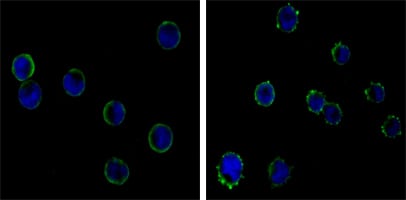Mouse Monoclonal Antibody to CD19