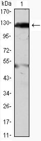 Mouse Monoclonal Antibody to JAK2