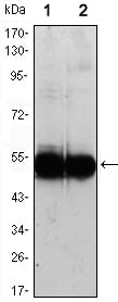 Mouse Monoclonal Antibody to VCAM1