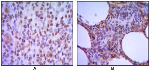 Mouse Monoclonal Antibody to MUM1