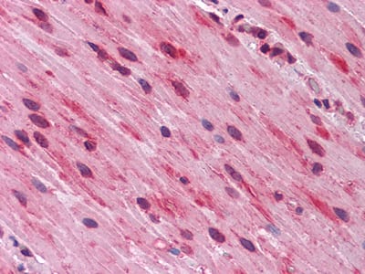 Mouse Monoclonal Antibody to GATA3