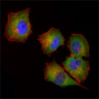 Mouse Monoclonal Antibody to NME1