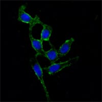 Mouse Monoclonal Antibody to FAK