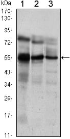Mouse Monoclonal Antibody to ETV5