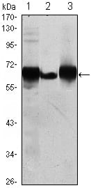 Mouse Monoclonal Antibody to ALPP