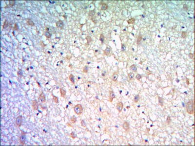 Mouse Monoclonal Antibody to KLHL21