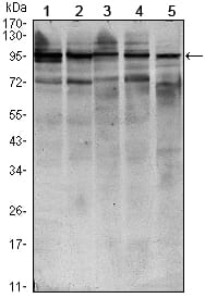 Mouse Monoclonal Antibody to STAT6